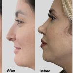 This Viral Jaw-Lifting Serum Is Like a Facelift in a Bottle