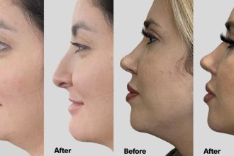 This Viral Jaw-Lifting Serum Is Like a Facelift in a Bottle