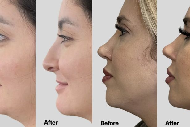 This Viral Jaw-Lifting Serum Is Like a Facelift in a Bottle