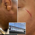 Two NYC Correction officers attacked in 4 hours at same Rikers jail — one by menace accused of brutal subway assault: union