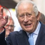 Why Cancer-Battling King Charles’ Fingers are So Swollen