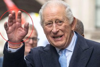 Why Cancer-Battling King Charles’ Fingers are So Swollen