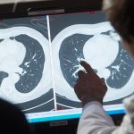 70 Percent of Cancer Patients Now Survive at Least Five Years, Study Finds