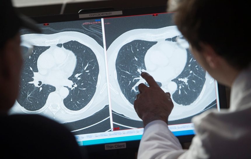 70 Percent of Cancer Patients Now Survive at Least Five Years, Study Finds
