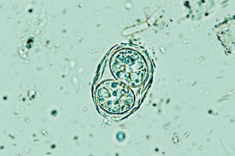 A Brain Parasite Infecting Millions Is Far Less Sleepy Than We Thought : ScienceAlert