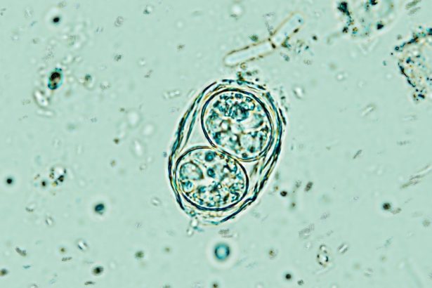 A Brain Parasite Infecting Millions Is Far Less Sleepy Than We Thought : ScienceAlert