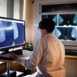 AI-assisted mammograms cut risk of developing aggressive breast cancer