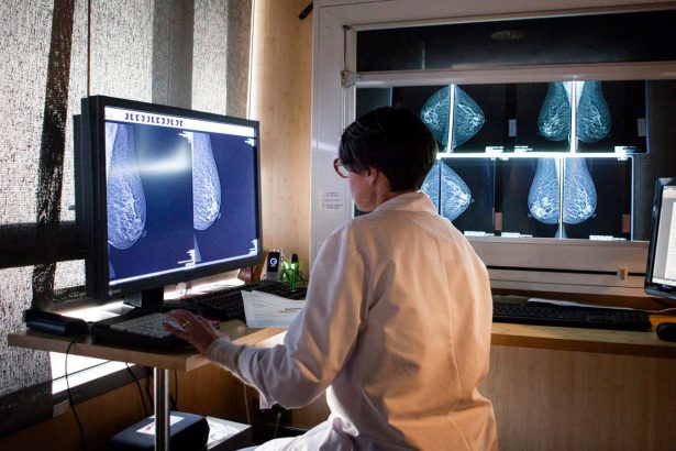 AI-assisted mammograms cut risk of developing aggressive breast cancer