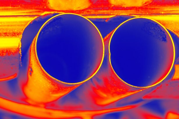 Air Pollution Linked to Higher ALS Risk And Faster Decline : ScienceAlert