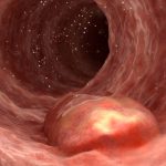 Barnacle gloop could improve inflammatory bowel disease treatments