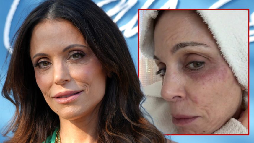 Bethenny Frankel Contracts Bacterial Infection After Partying in St. Barths