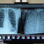 Doctors keep patient alive using ‘artificial lungs’ for two days