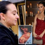 Ex-NJ GOP aide still carries visible scars after she paid fetish artist to carve her up