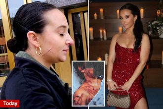 Ex-NJ GOP aide still carries visible scars after she paid fetish artist to carve her up