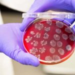 Faecal transplants could boost the effectiveness of cancer treatments