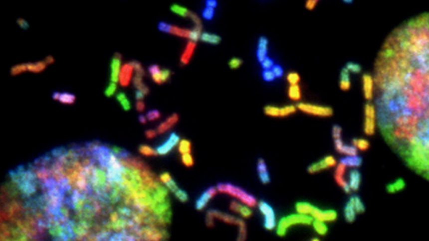 Gene therapy startup Altido Bio takes aim at glioblastoma brain tumors