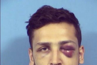 Home invader gets black eye from residents, 20-year sentence from judge