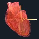 Huge Study Links 99% of Heart Attacks And Strokes With 4 Risk Factors : ScienceAlert