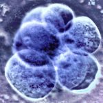 Natural ovulation the best option before an IVF frozen embryo transfer