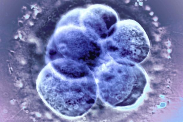 Natural ovulation the best option before an IVF frozen embryo transfer