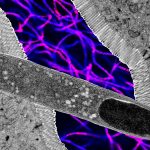 One Gut Microbe Blocks Weight Gain in Mice on a High-Fat Diet : ScienceAlert