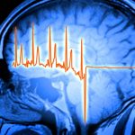 Our brains play a surprising role in recovering from a heart attack