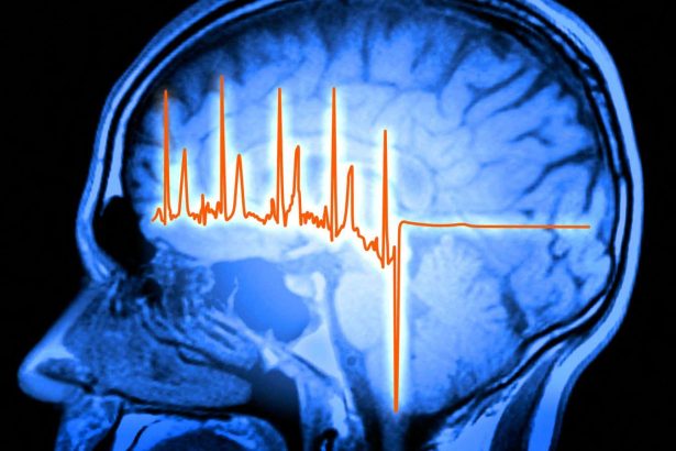 Our brains play a surprising role in recovering from a heart attack