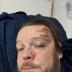 ‘Pawn Stars’ Corey Harrison Hospitalized After Crash, Will Miss Dad’s Wedding
