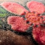 Red Tattoos Triggered Shocking Immune Reactions in Polish Man : ScienceAlert