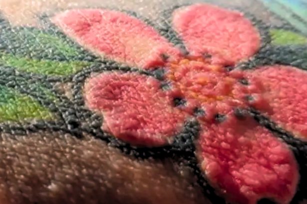 Red Tattoos Triggered Shocking Immune Reactions in Polish Man : ScienceAlert