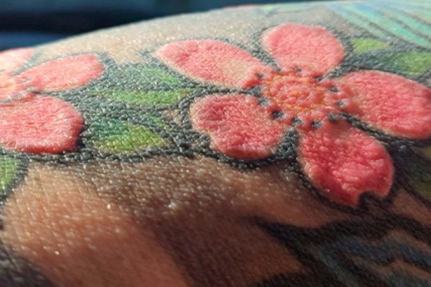 Red tattoo ink causes man to lose all his hair and stop sweating