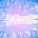 Scientists Are Finally Closing In on a Treatment For Huntington’s Disease : ScienceAlert