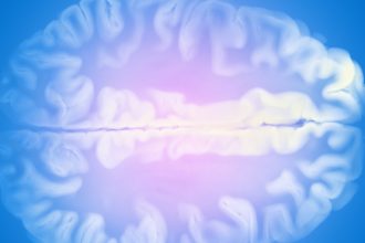 Scientists Are Finally Closing In on a Treatment For Huntington’s Disease : ScienceAlert