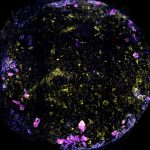 Scientists Made This Lung-on-a-Chip Breathe. Then They Gave It TB. : ScienceAlert