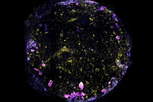 Scientists Made This Lung-on-a-Chip Breathe. Then They Gave It TB. : ScienceAlert