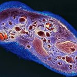 Strips of dried placenta help wounds heal with less scarring