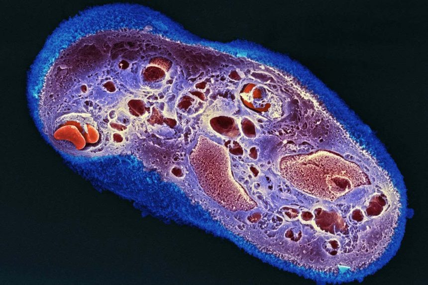 Strips of dried placenta help wounds heal with less scarring