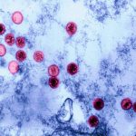 The Epstein-Berr virus infects most of us – but why do only some get very ill?