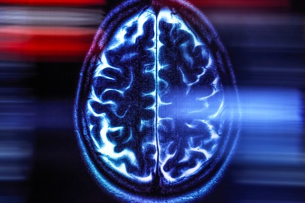 There’s One Critical Thing You Can Do to Cut Your Risk of Dementia : ScienceAlert