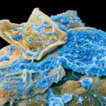 Unusual oral microbiome signature linked to obesity