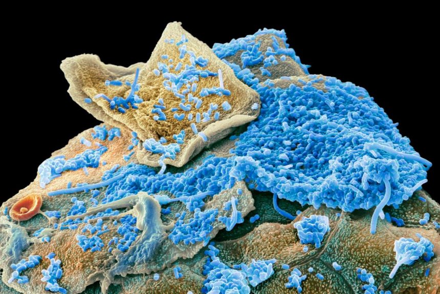 Unusual oral microbiome signature linked to obesity