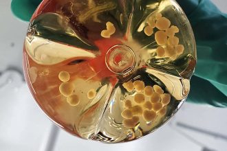 We’re getting closer to growing a brain in a lab dish