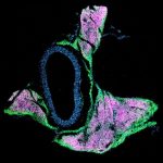 What Is Beige Fat, and Is It Healthy?