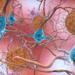 Why people can have Alzheimer’s-related brain damage but no symptoms