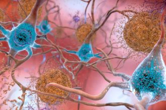 Why people can have Alzheimer’s-related brain damage but no symptoms
