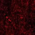 Accidental discovery hints at mystery structures within our brain