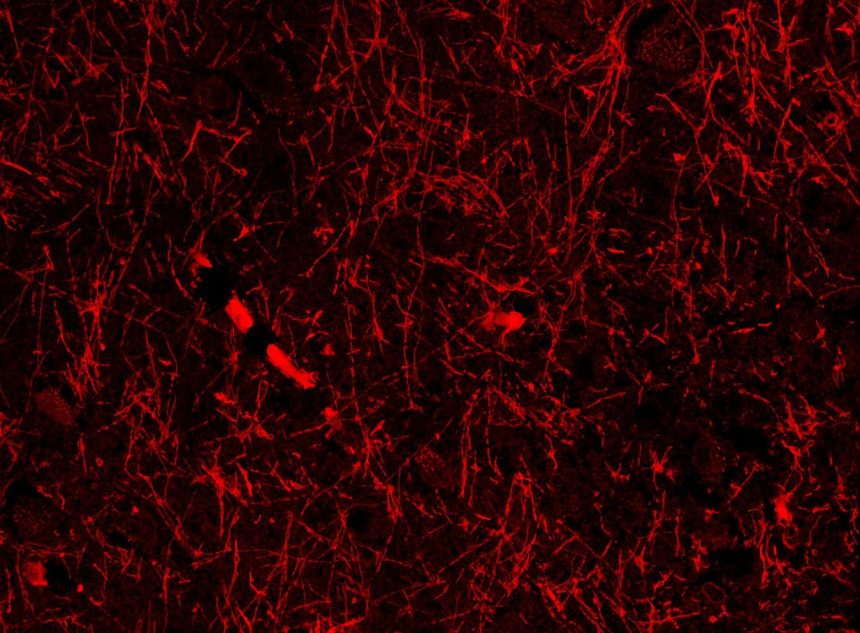 Accidental discovery hints at mystery structures within our brain