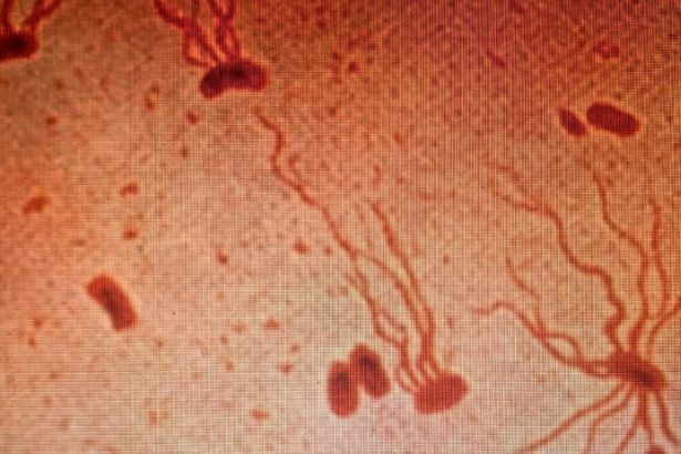 Ancient Killer Is Rapidly Gaining Resistance to Antibiotics, Scientists Warn : ScienceAlert