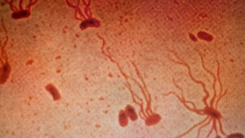 Ancient Killer Is Rapidly Gaining Resistance to Antibiotics, Scientists Warn : ScienceAlert