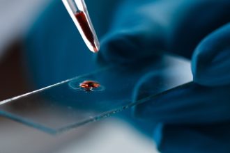 Blood Test ‘Clock’ Can Predict Alzheimer’s Symptoms Before They Emerge : ScienceAlert